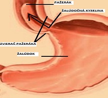 Príčiny a prevencia