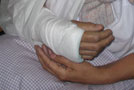 Zlomenina ruky (zápästia) - čo robiť po odstránení sádry